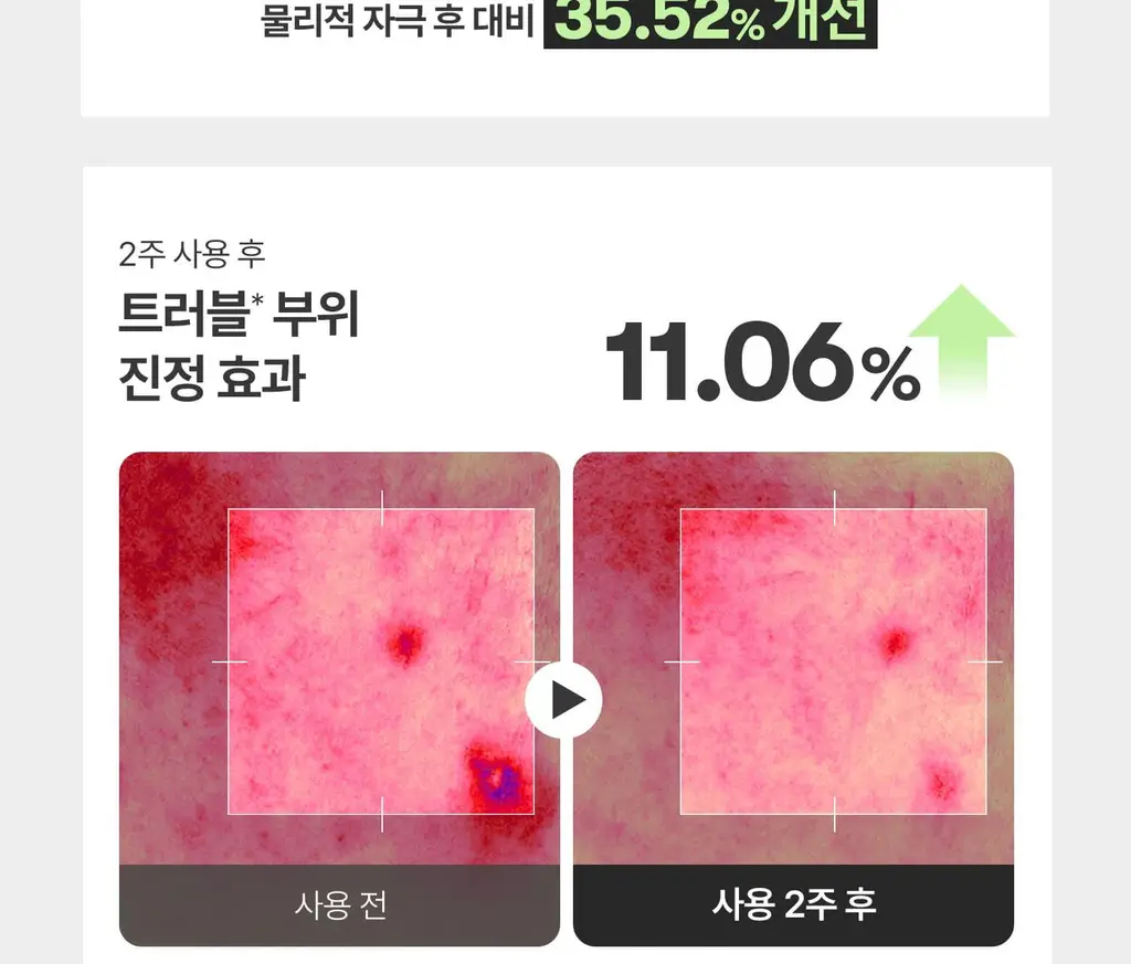 [4천만돌파/모공] VT 리들샷 100 에센스50ml 기획 (+리들샷300 1ml*3개+PDRN에센스1.5ml*3ea) 상세페이지 23